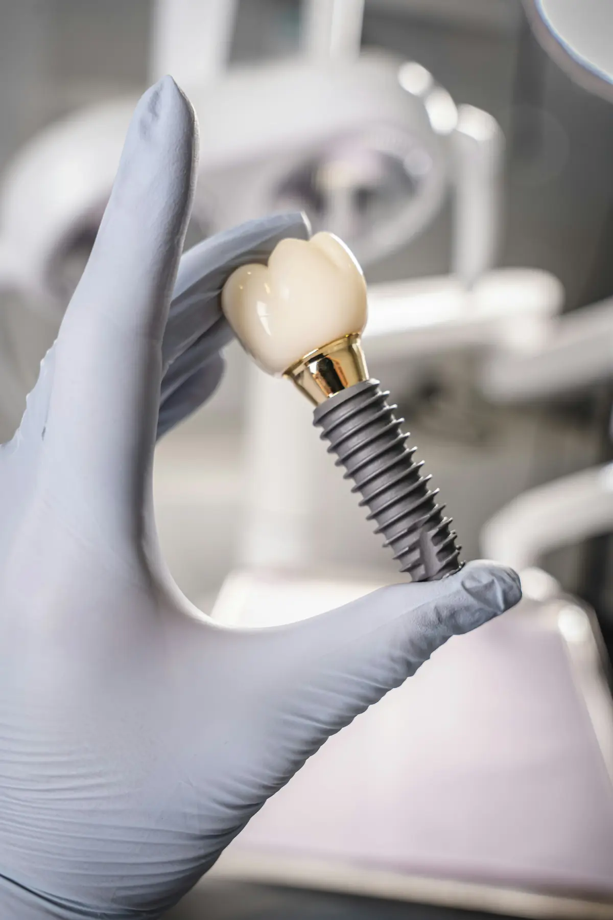 A gloved hand holding a dental implant model