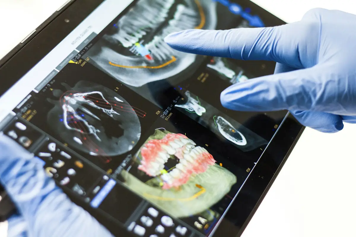 A dentist pointing at a 3D scan of teeth on a tablet